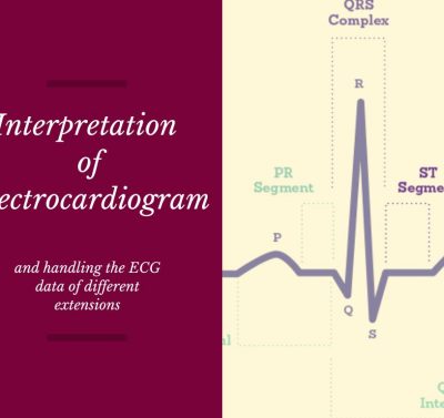 Interpretation of ECG