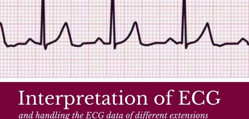 Interpretation-ECG
