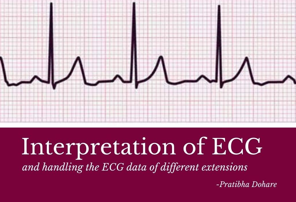 Interpretation-ECG